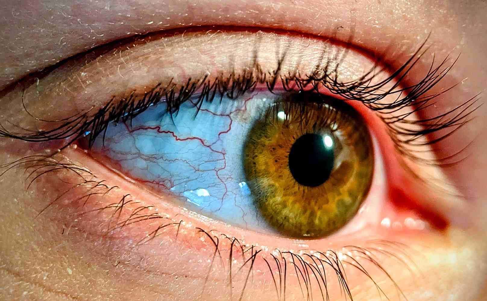 Honey Colored Eyes