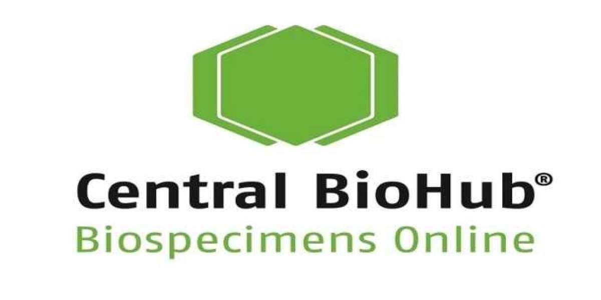 Central BioHub’s Role in Advancing Glaucoma and Cataract Studies through Aqueous Humor Samples