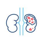 Kidney Cancer Profile Picture